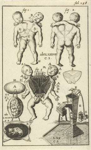 Anatomical image VI, Jan Luyken, 1680 - 1688 Canvas Print