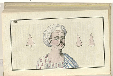 Le Mois, Journal historique, littéraire et critique, avec figures, no. 14: Chirurgie: Opération singuliere pratique aux Indes, anonymous, 1800 Canvas Print