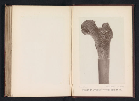 Inside of the upper part of the femur of a 103-year-old, anonymous, c. 1879 - in or before 1889 Canvas Print